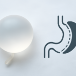 Symbolische weergave van een maagballon en een gastric sleeve naast elkaar